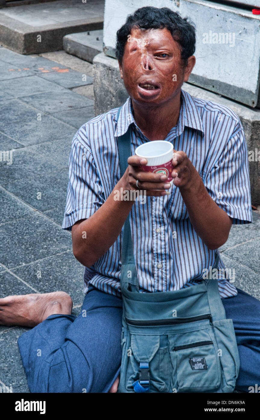 [Image: beggar-with-leprosy-in-bangkok-thailand-DN6K9A.jpg]