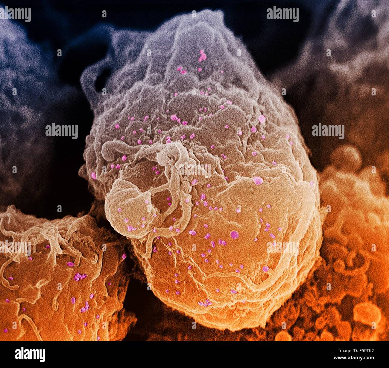 Scanning electron micrograph (SEM) of human immunodeficiency virus