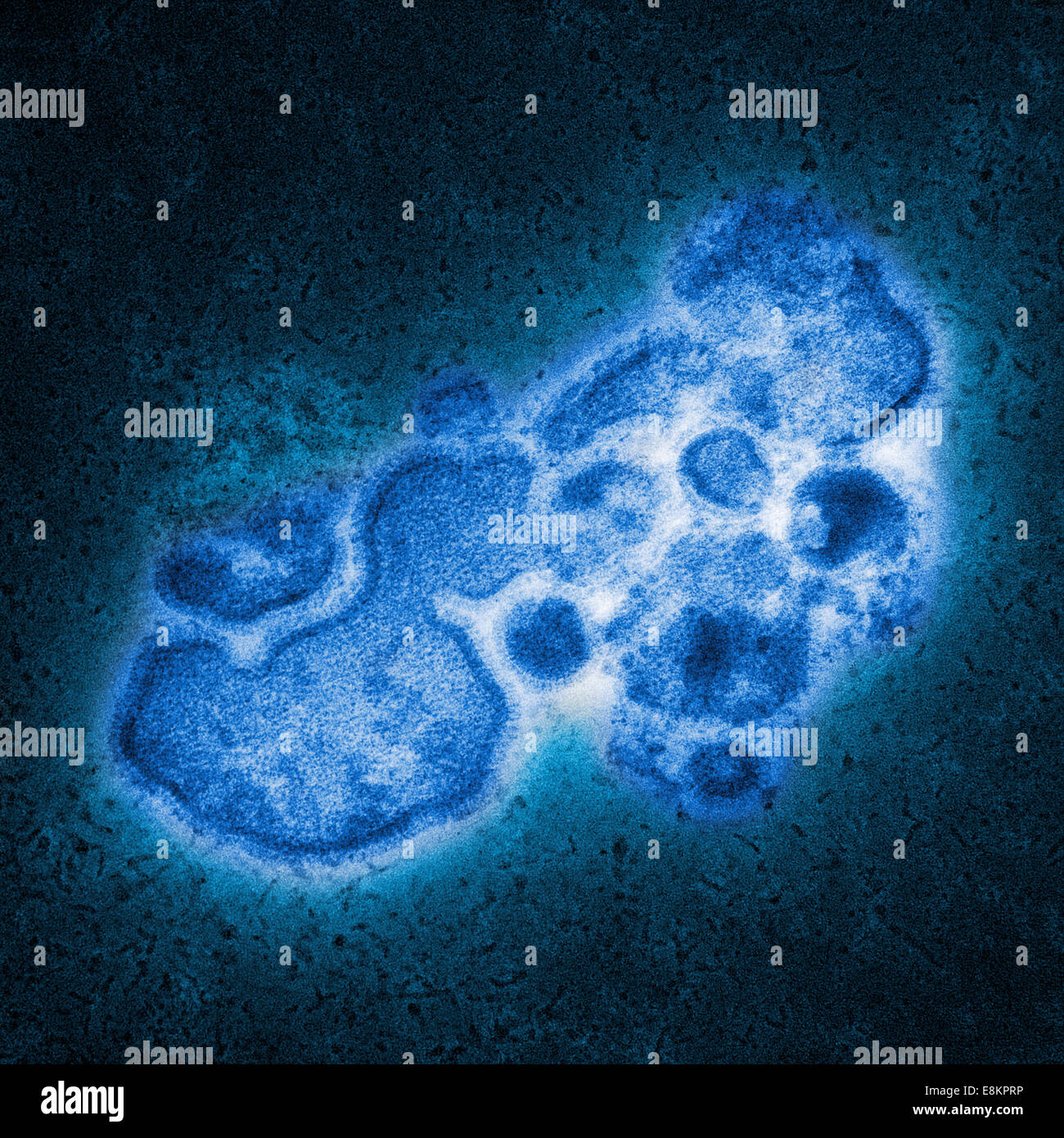 This Colorized Negatively Stained Transmission Electron Micrograph Tem