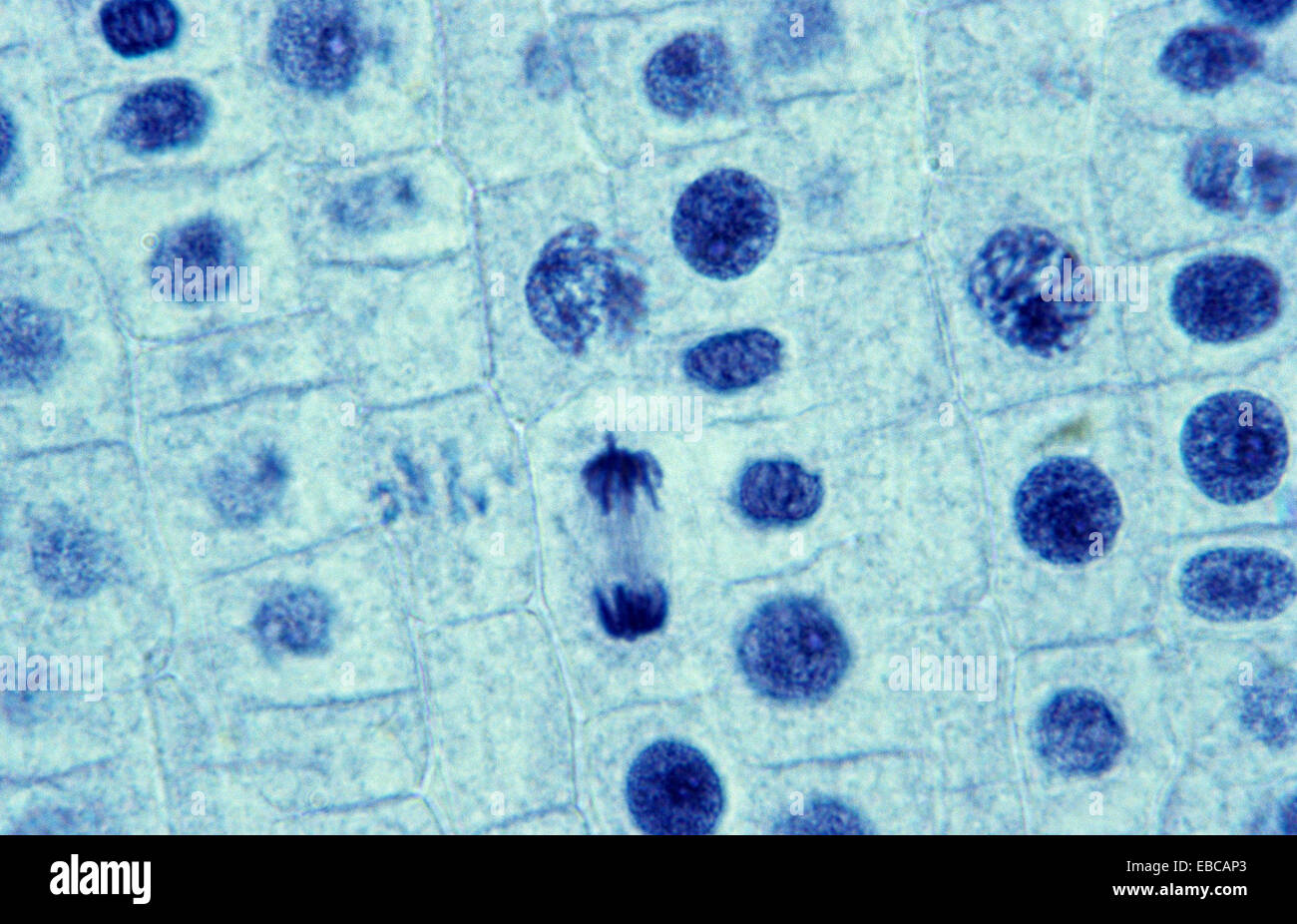 Mitosis in the onion root tip, Telophase, 1000 X optical microscope