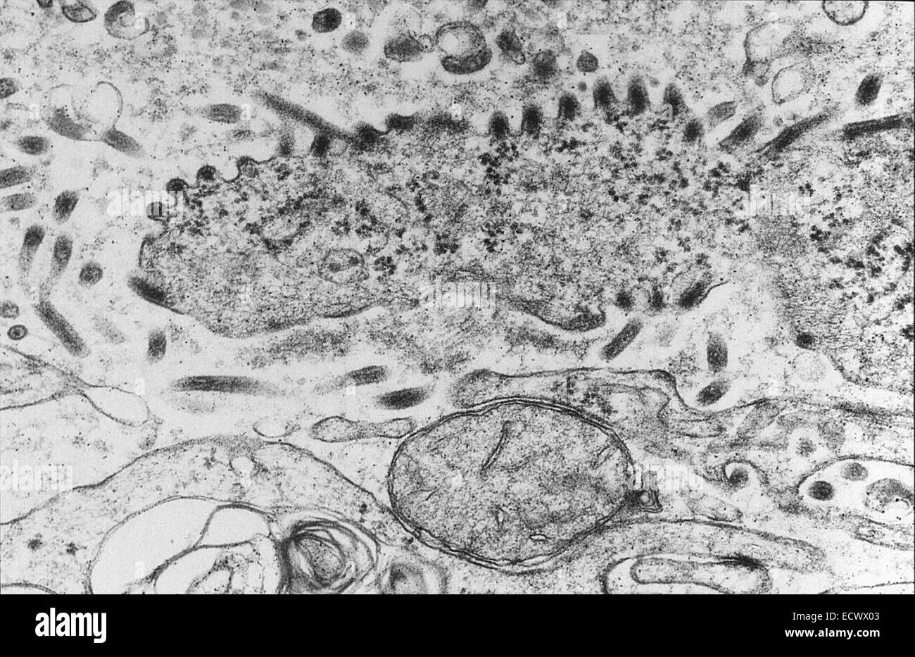 Transmission Electron Micrograph Of Ebola Virus Virions Stock Photo Alamy