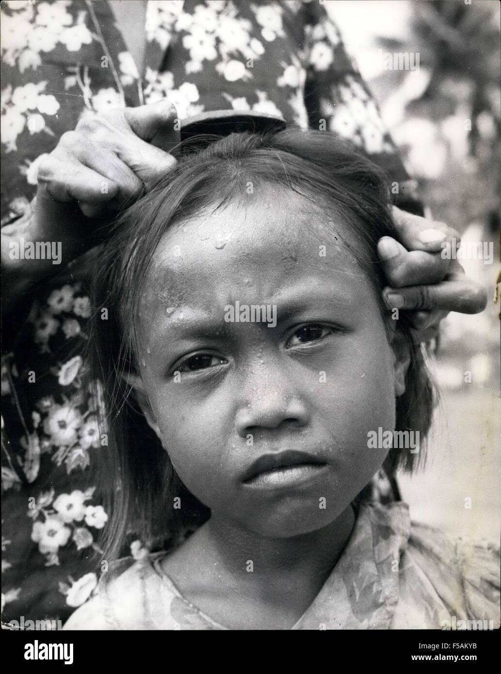 1968 - Leprosy is still a scourge in the East: Indonesia makes efforts to control it by opening Leprosariums: Almost entirely unknown today in the Western ... - 1968-leprosy-is-still-a-scourge-in-the-east-indonesia-makes-efforts-F5AKYB