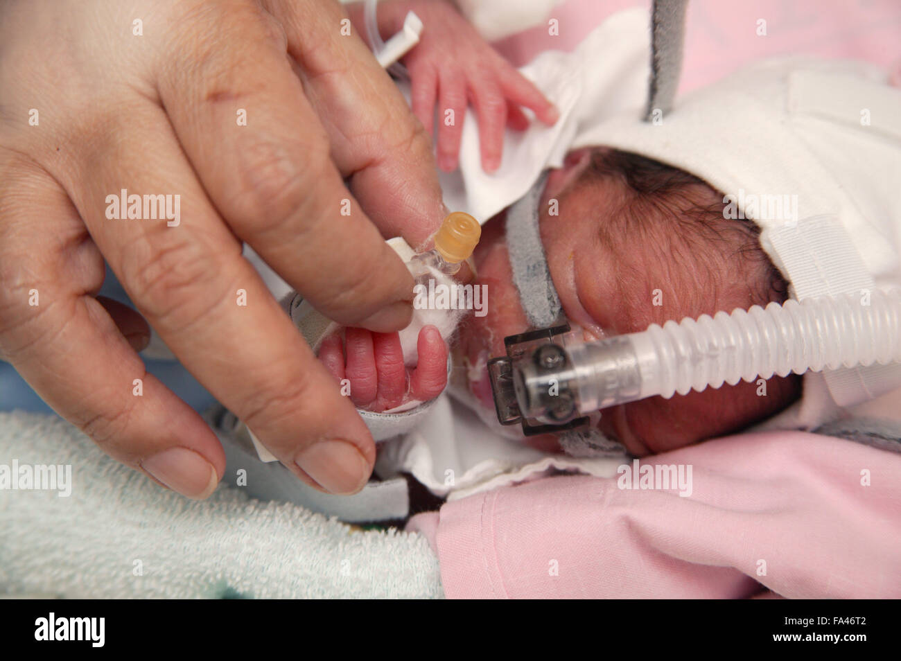 Cpap Neonatal Hi Res Stock Photography And Images Alamy