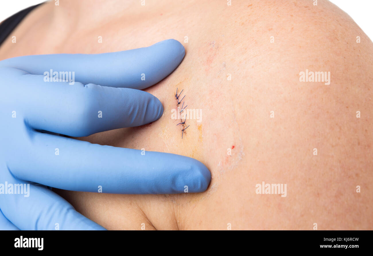 Viagra use before surgery