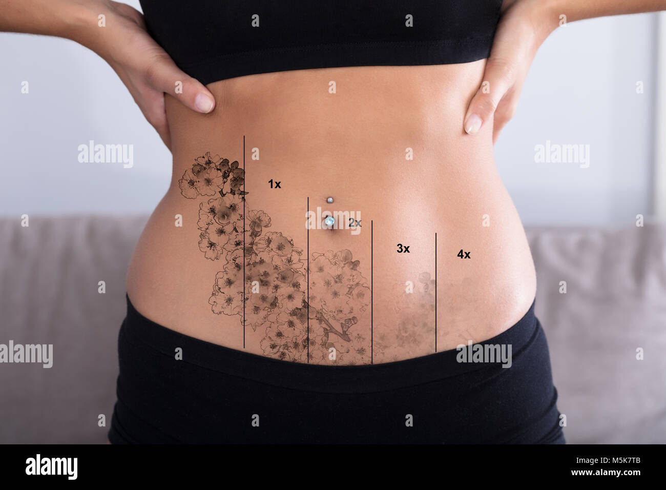 tattoo removal laser stock photos amp tattoo removal laser tattoo removal laser stock photos amp tattoo removal laser