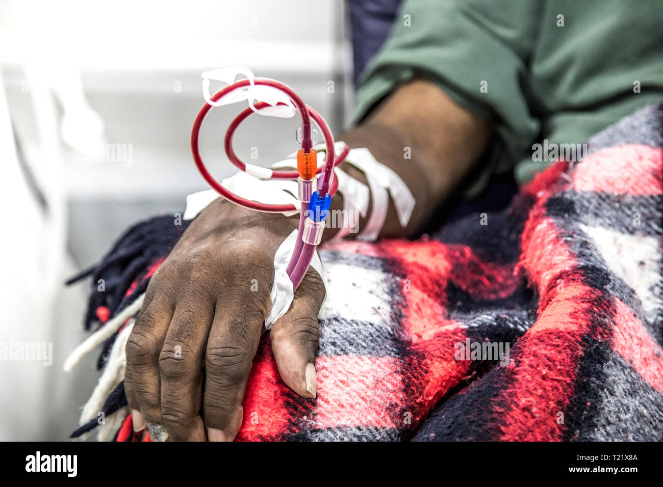 Hemodialysis Hi Res Stock Photography And Images Alamy