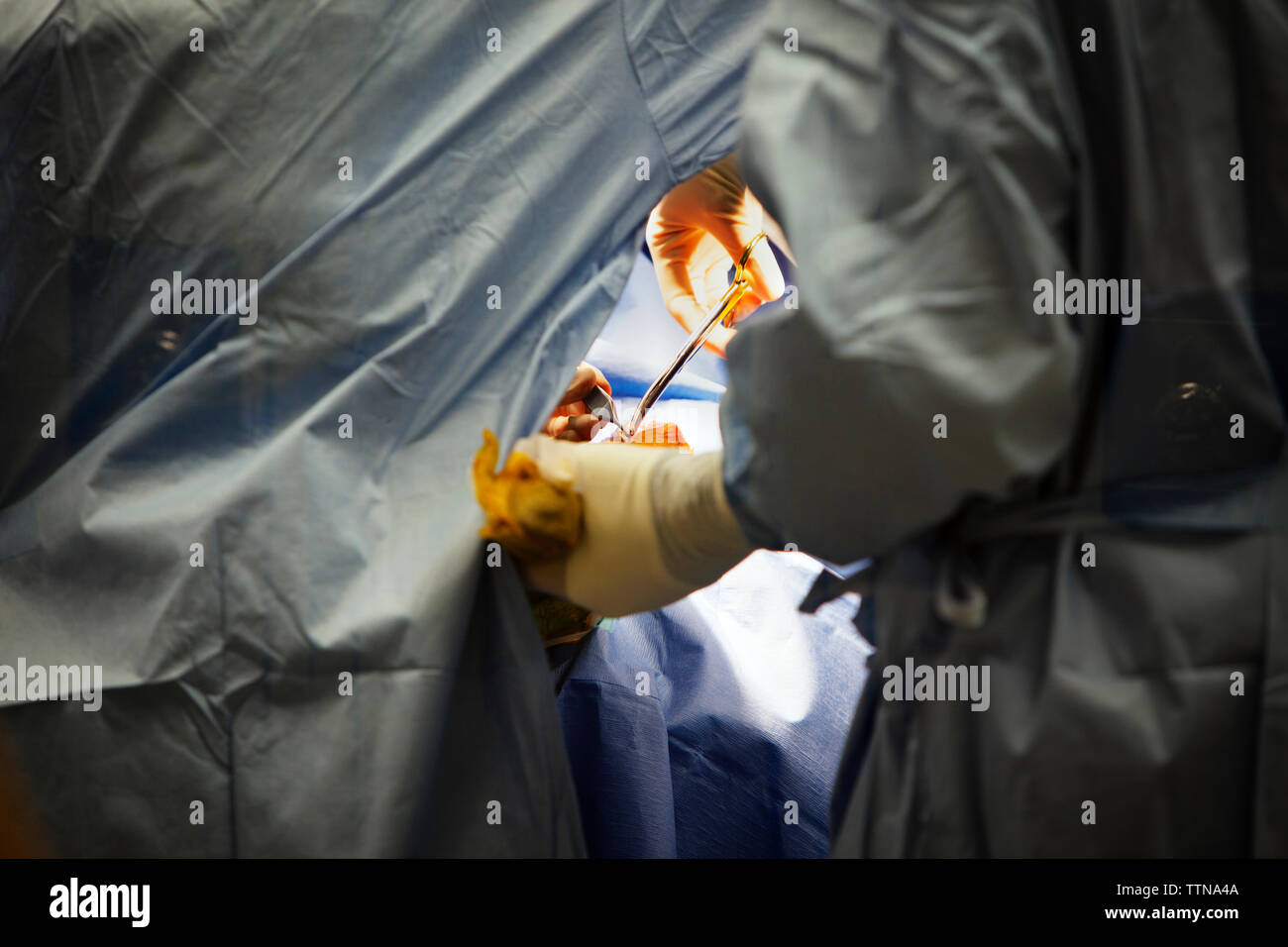 Surgeons During Operation Stock Photo Alamy
