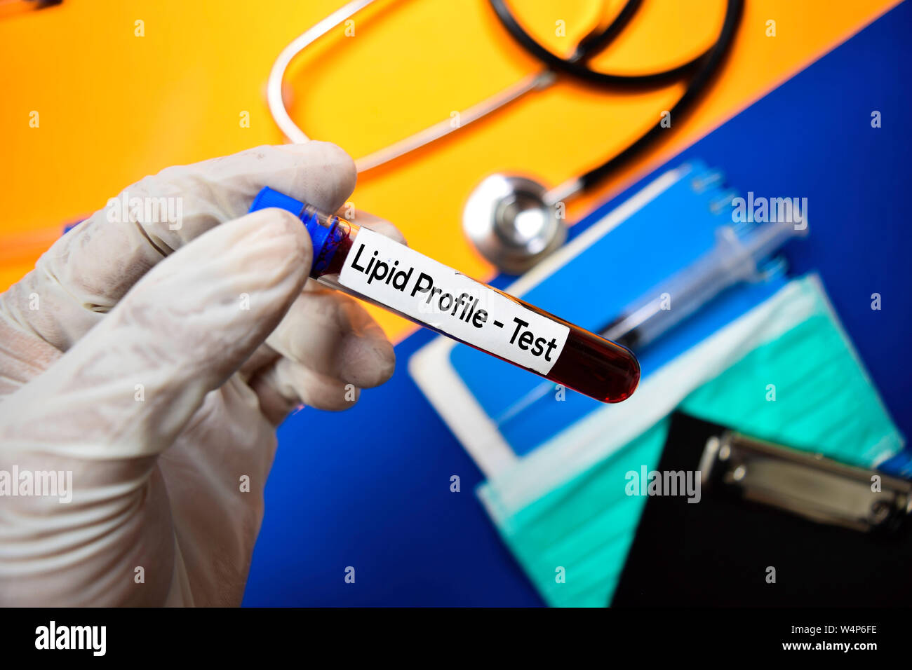 Lipid Profile Test With Blood Sample Top View Isolated On Color