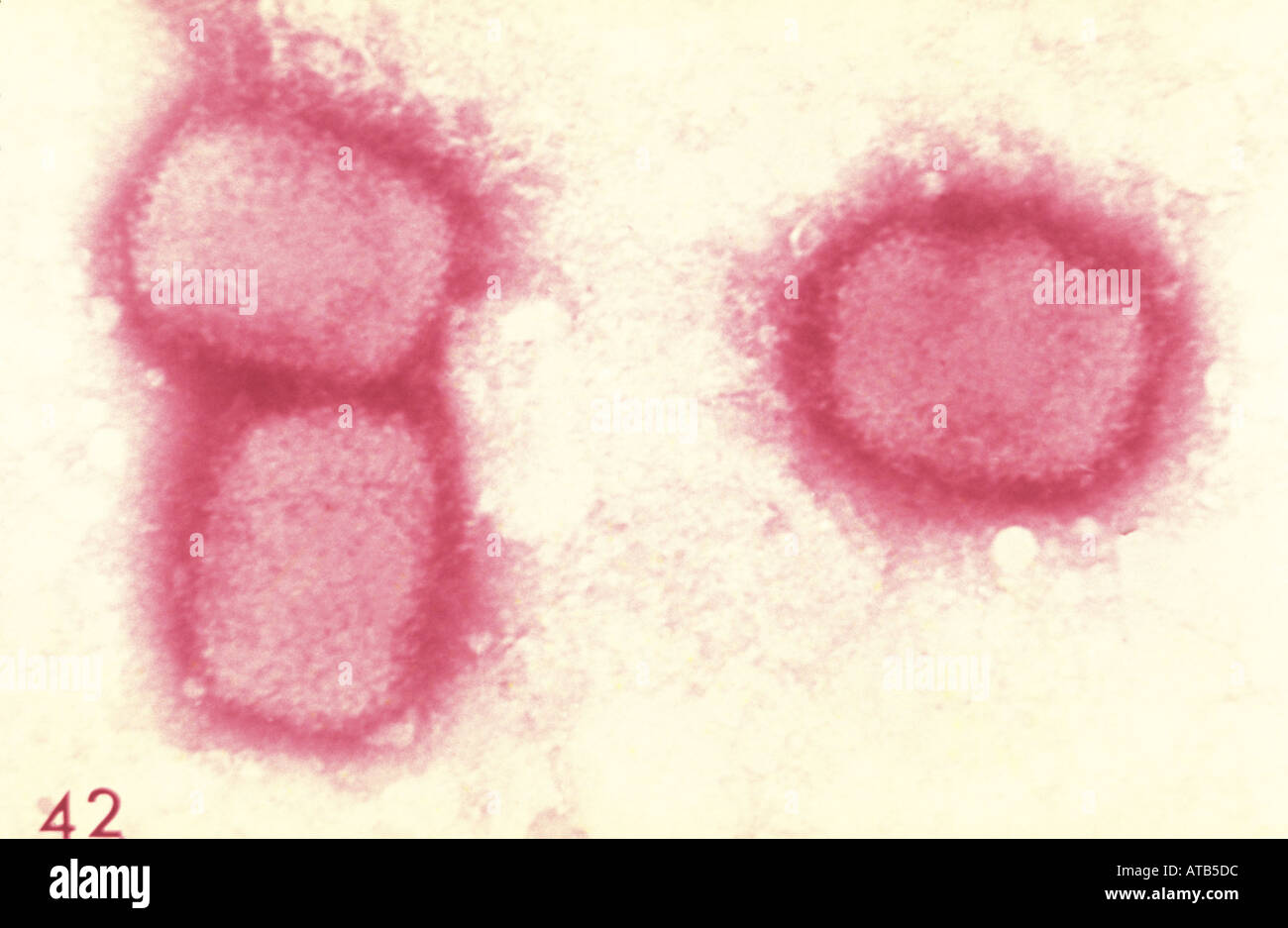 Variola Minor Stockfotos & Variola Minor Bilder Alamy