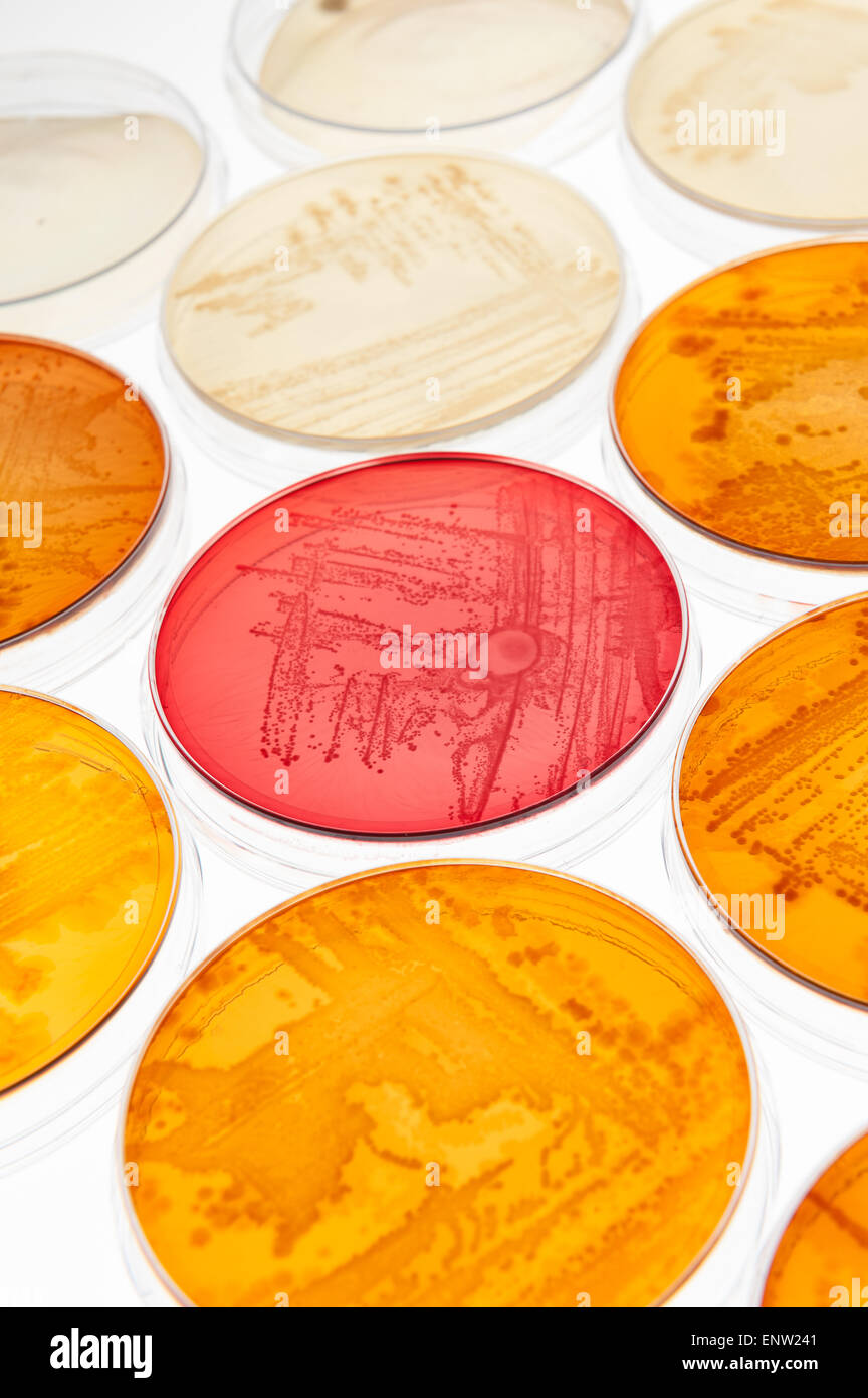 Macconkey Agar Eine Selektive Klinische Mikrobiologie Labor