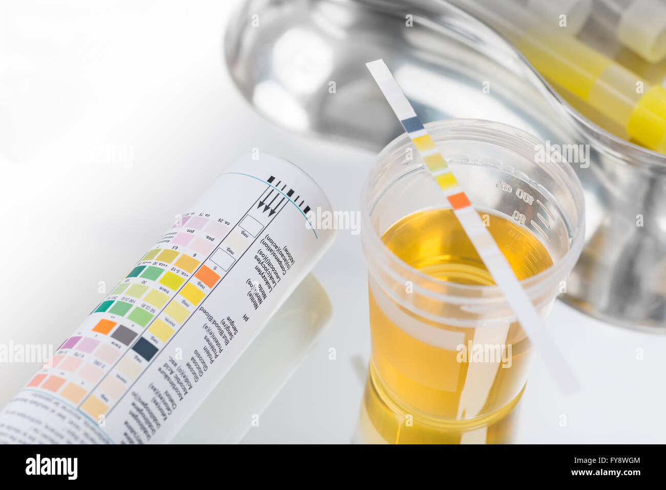 Stückprüfung, UrinSchnelltest, UrinTeststreifen, Urinprobe Stockfoto