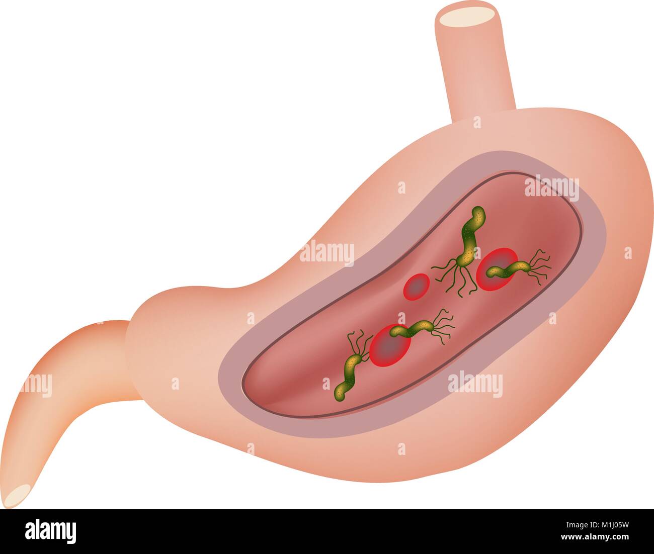 Magen Helicobacter Pylori Vector Illustration Auf Isolierte