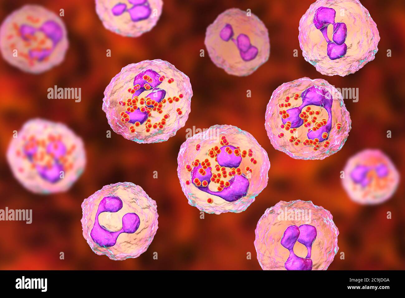 Meningitis Meningoc Cica Ilustraci N De Computadora Que Muestra El