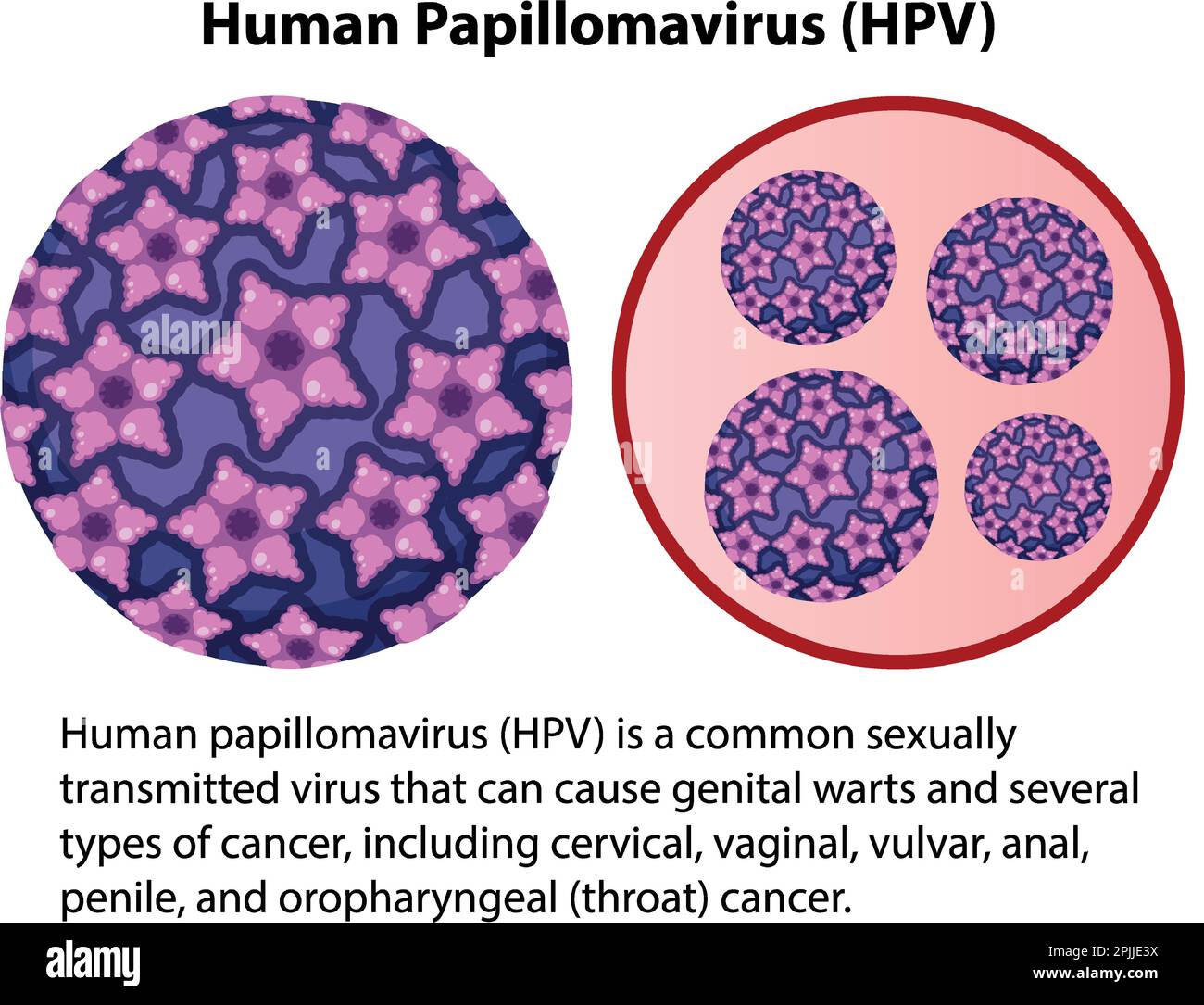 Virus del papiloma humano con ilustración de explicación Imagen Vector