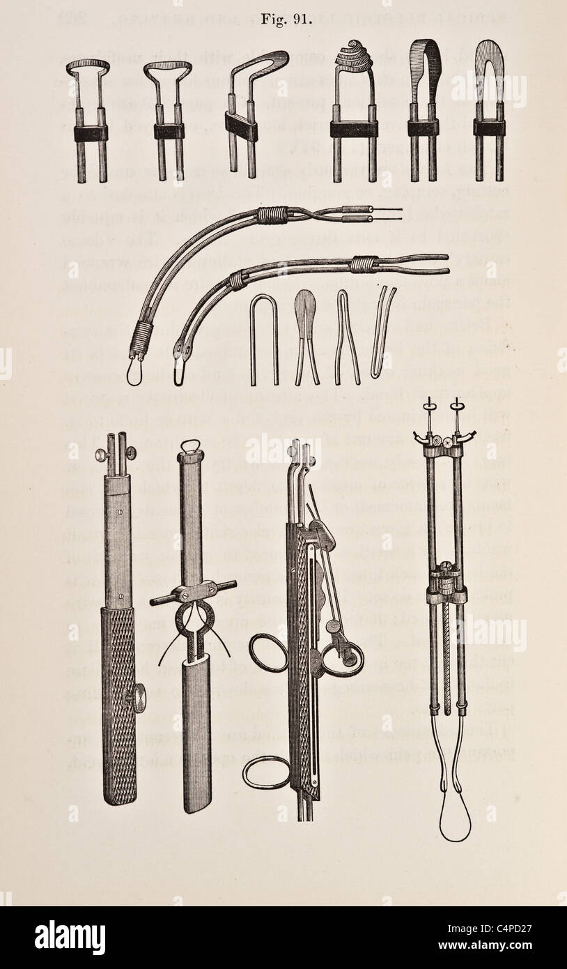 Ilustración de antiguos instrumentos quirúrgicos y aparatos médicos