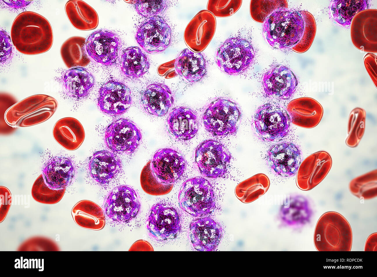 Tratamiento De La Leucemia Linfobl Stica Aguda De Concepto Ilustraci N