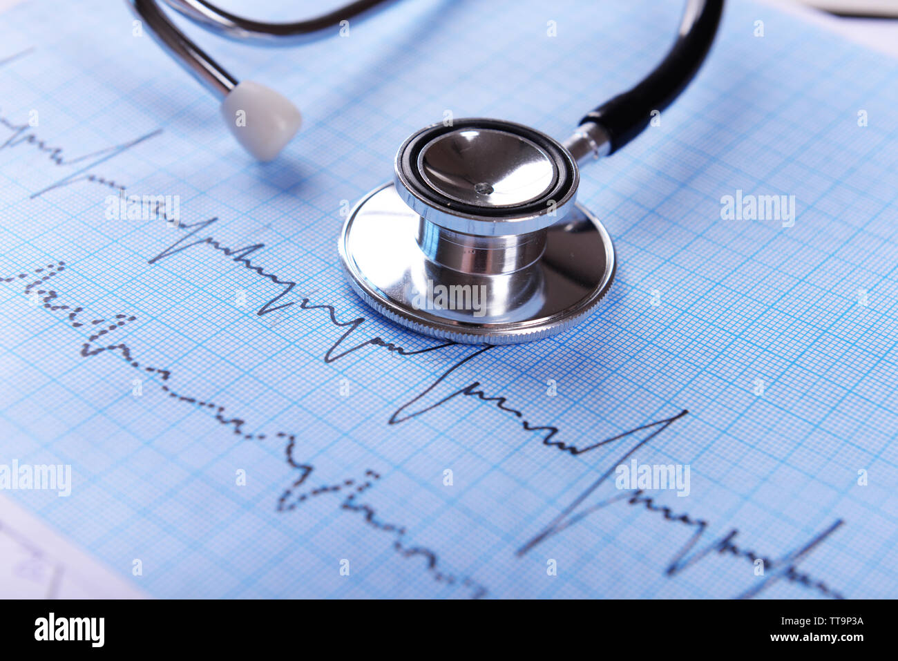 Electrocardiograma Realizado Con Estetoscopio Sobre Tabla Closeup