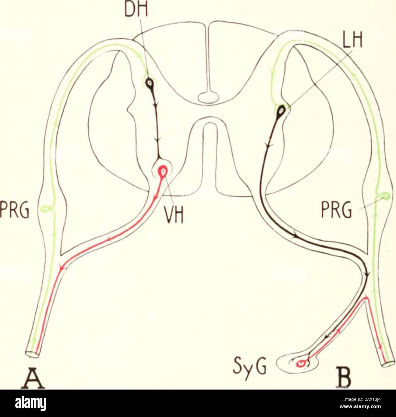 Tuberculose Clinique Niustre Sch Matiquement Le Cours Des Fibres