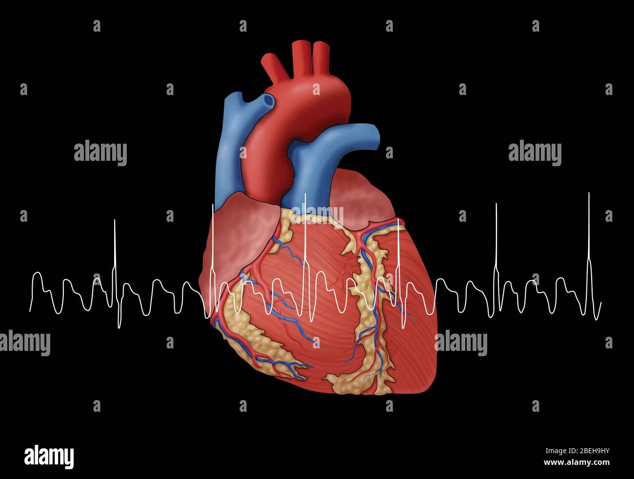 Flutter Atriale Ekg Immagini E Fotografie Stock Ad Alta Risoluzione Alamy