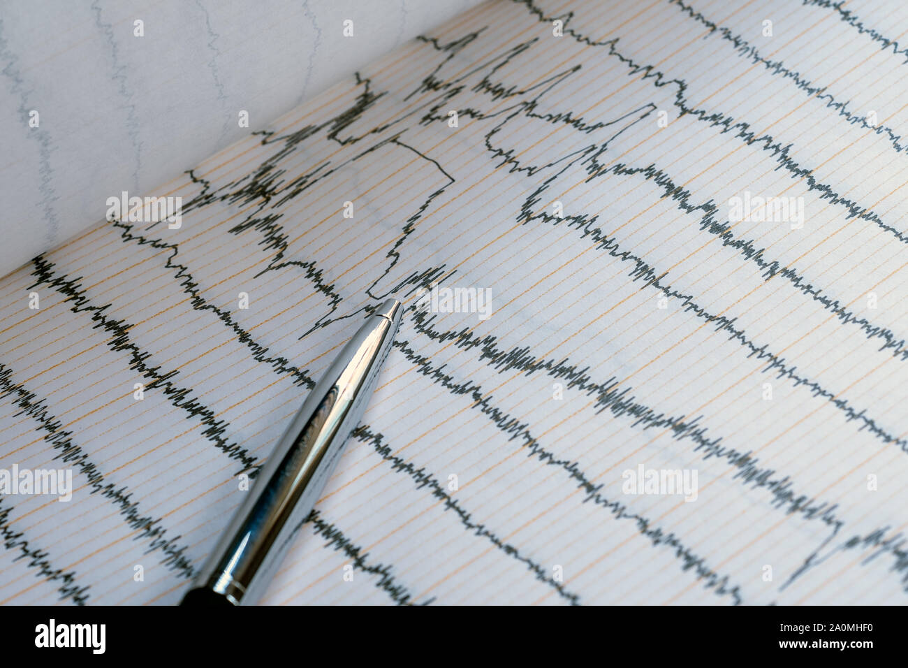 EEG wave in human brain, brain wave patterns on electroencephalogram ...