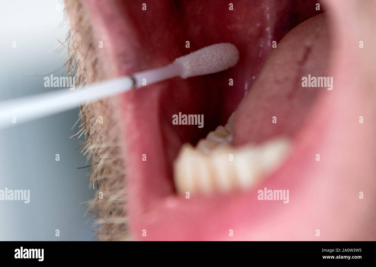 Dna mouth swab hires stock photography and images Alamy