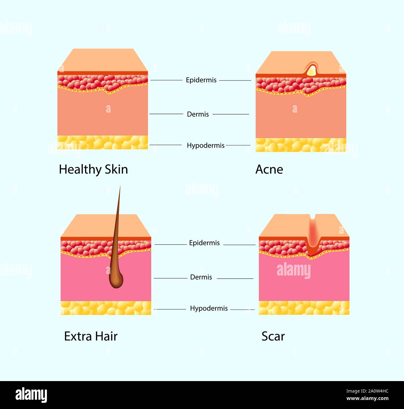 Vector Illustration Of Types Of Skin Problems Isolated Stock