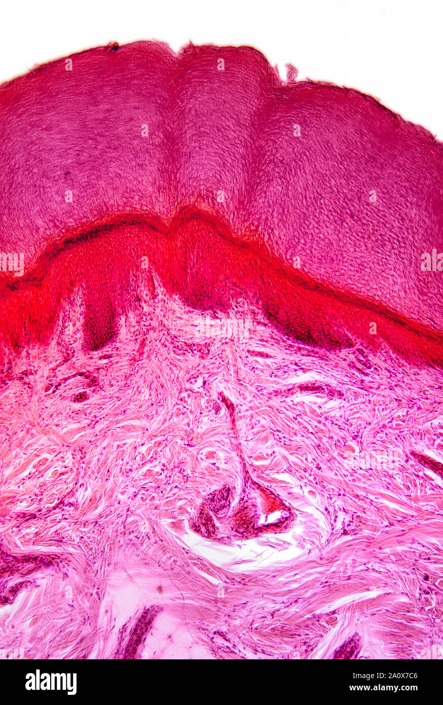 Frog, Rana sp. skin section & gland detail, stained section, brightfield photomicrograph Stock Photo