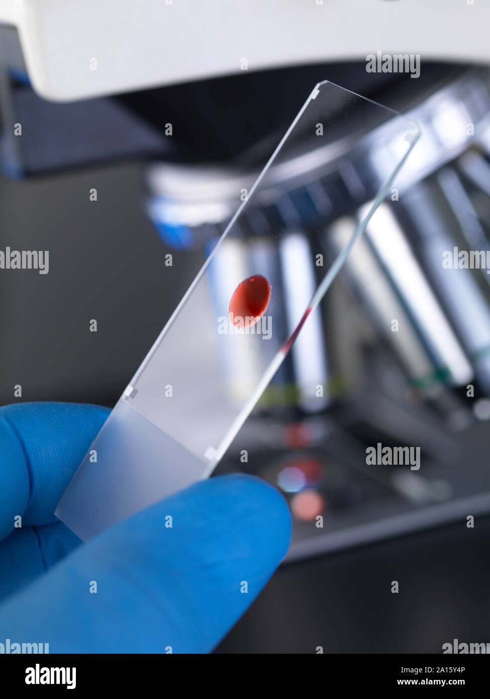Scientist examining a glass slide containing a human sample under a microscope Stock Photo