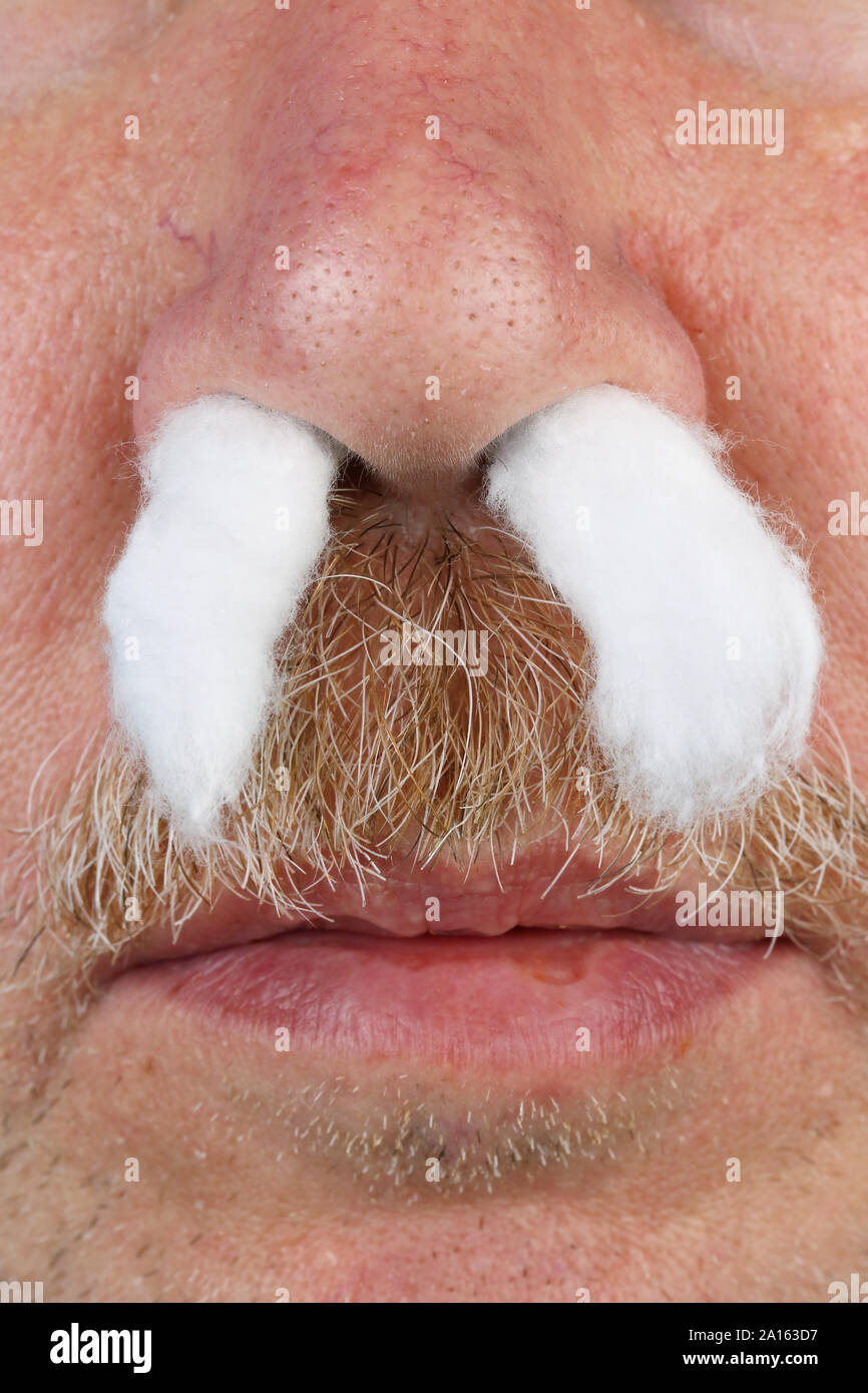 Alcohol swabs hires stock photography and images Alamy