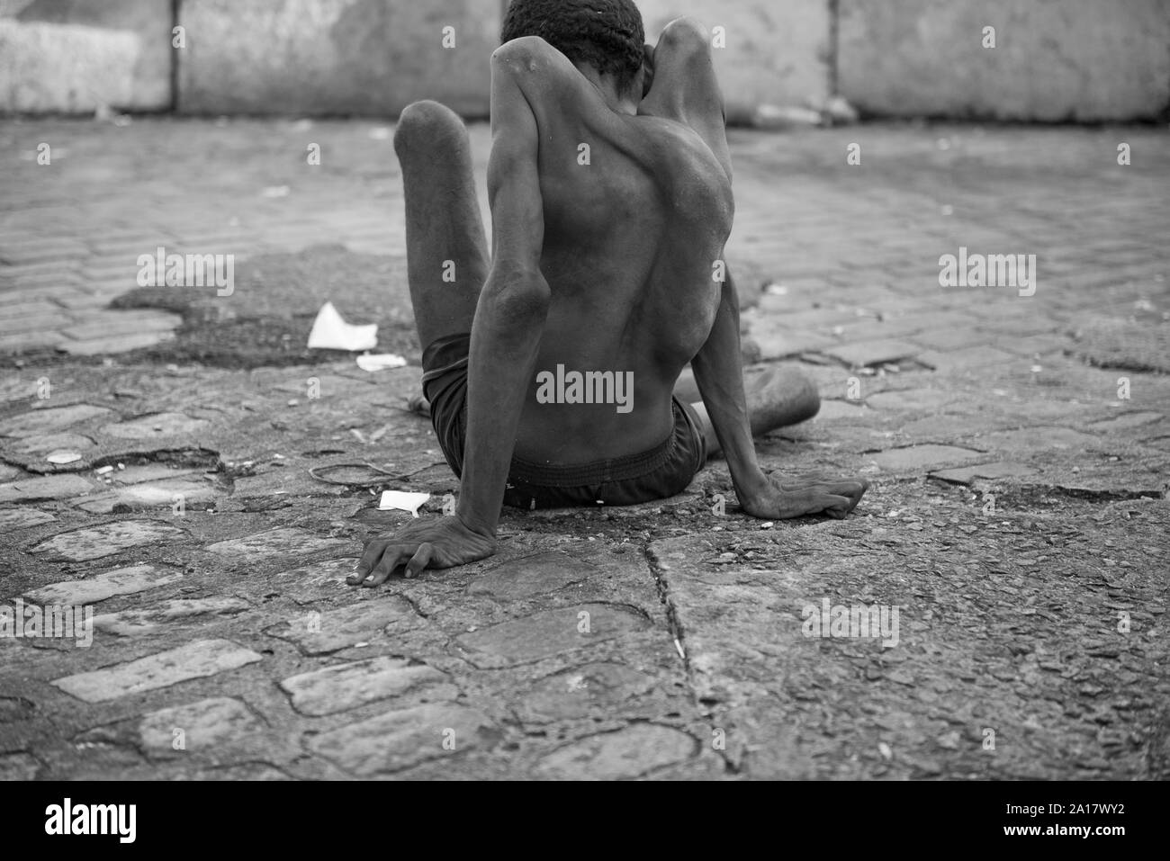 Homeless man with congenital disease seated  in Recife streets Stock Photo