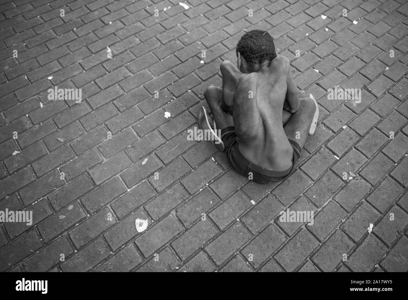 Man with congenital disease seated  in a Recife downtown sidewalk Stock Photo