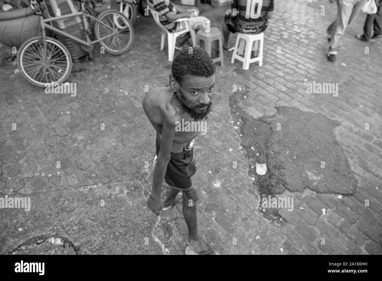 Homeless man with congenital disease in the streets of Recife downtown Stock Photo