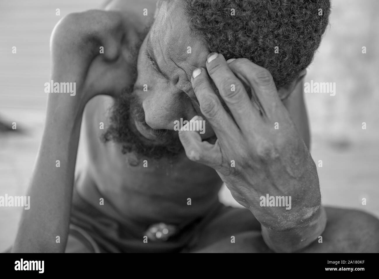 Portrait of homeless man with congenital disease in Recife downtown Stock Photo