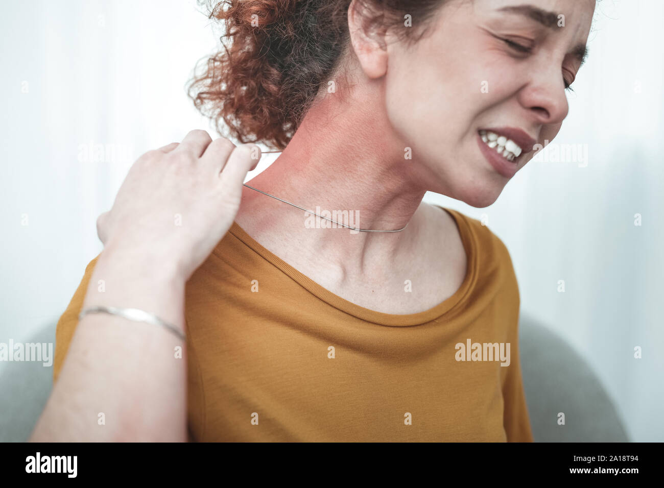 Woman wearing orange shirt having rash and reddening on neck Stock Photo