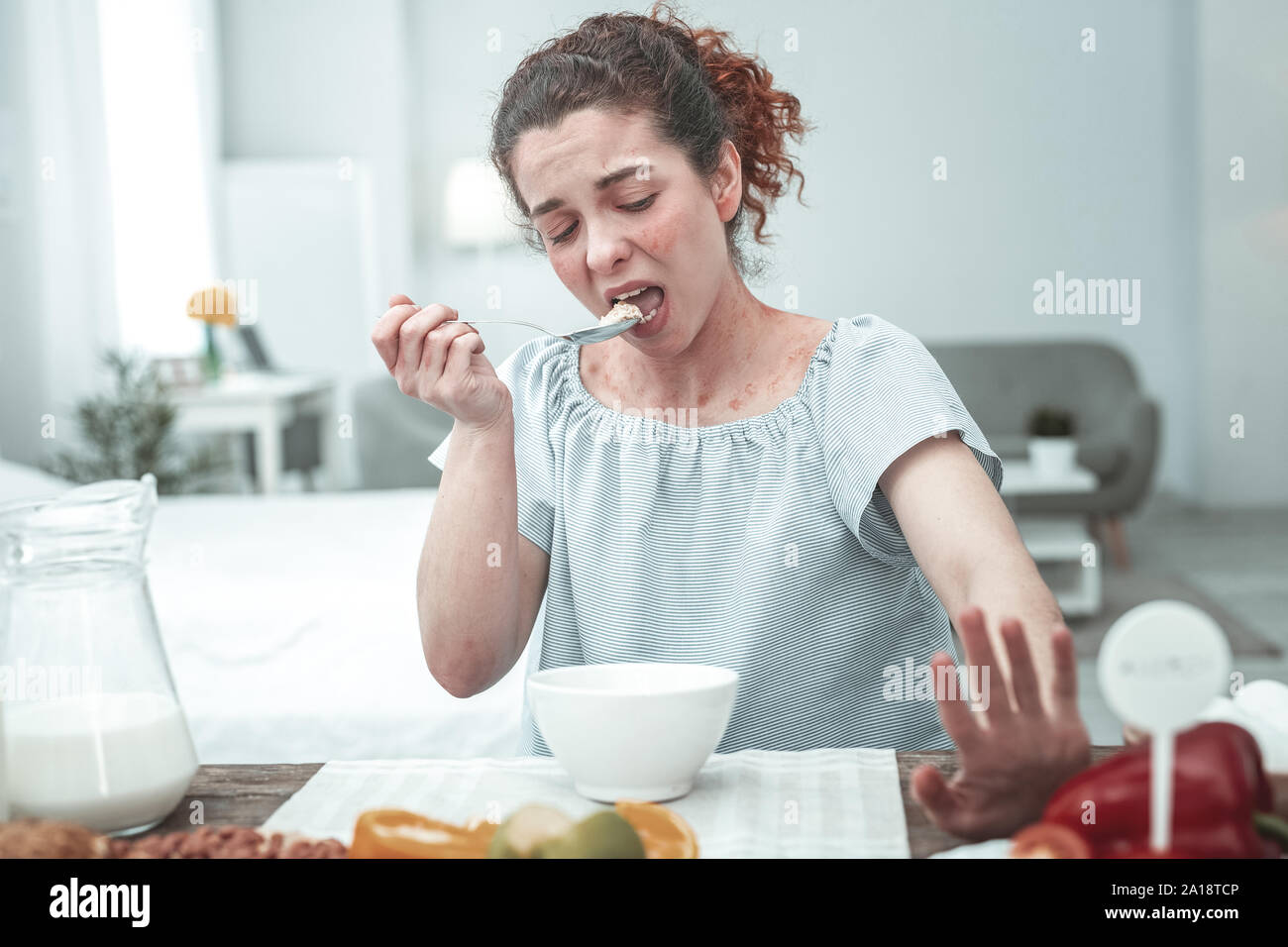 Woman with rash over all body having breakfast full of allergens Stock ...