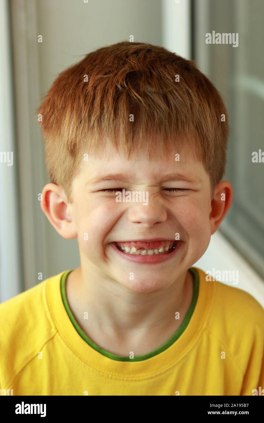 Close up portrait of a boy in a yellow T-shirt screwing up his eyes whose front top milk teeth have fallen out Stock Photo