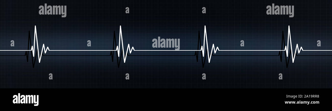 medical banner illustrating arrhythmia slow heart rate on ecg, bradycardia heart rate less than 60 beats per minute Stock Photo