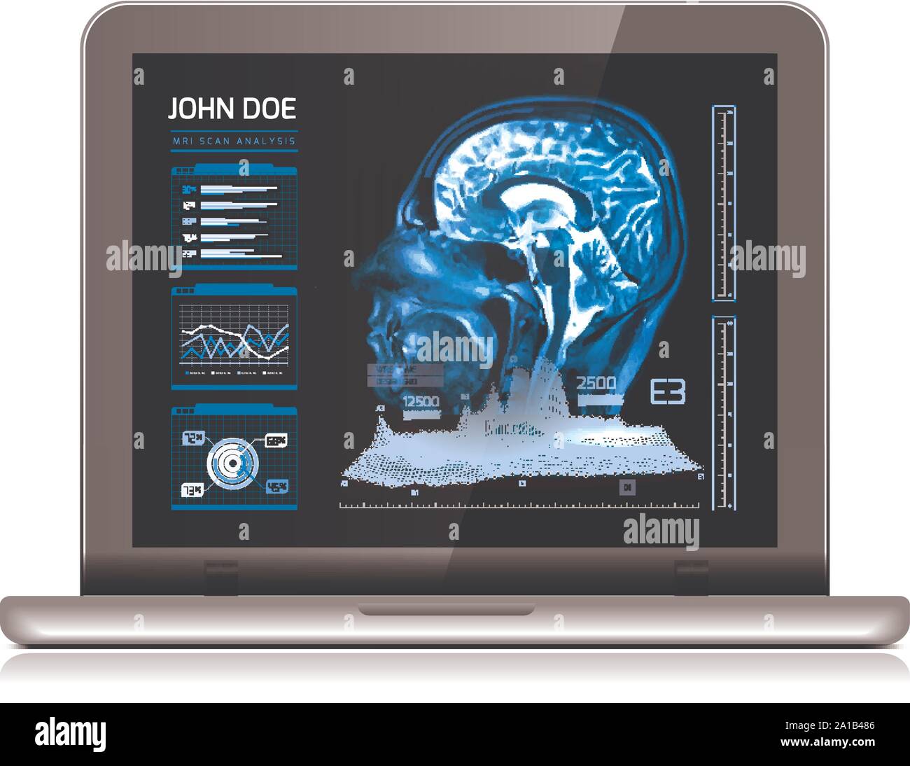 Notebook monitor with medical MRI and other real-time analyzes. Medicine of the future. Vector illustration on white Stock Vector