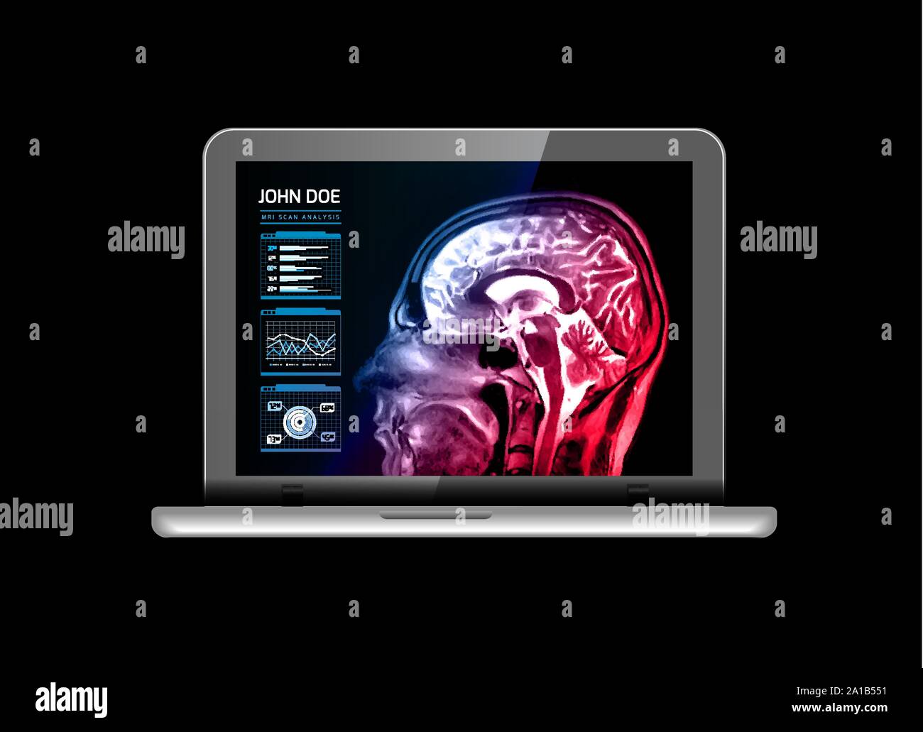 Notebook monitor with medical MRI and other real-time analyzes. Medicine of the future. Vector illustration on black Stock Vector