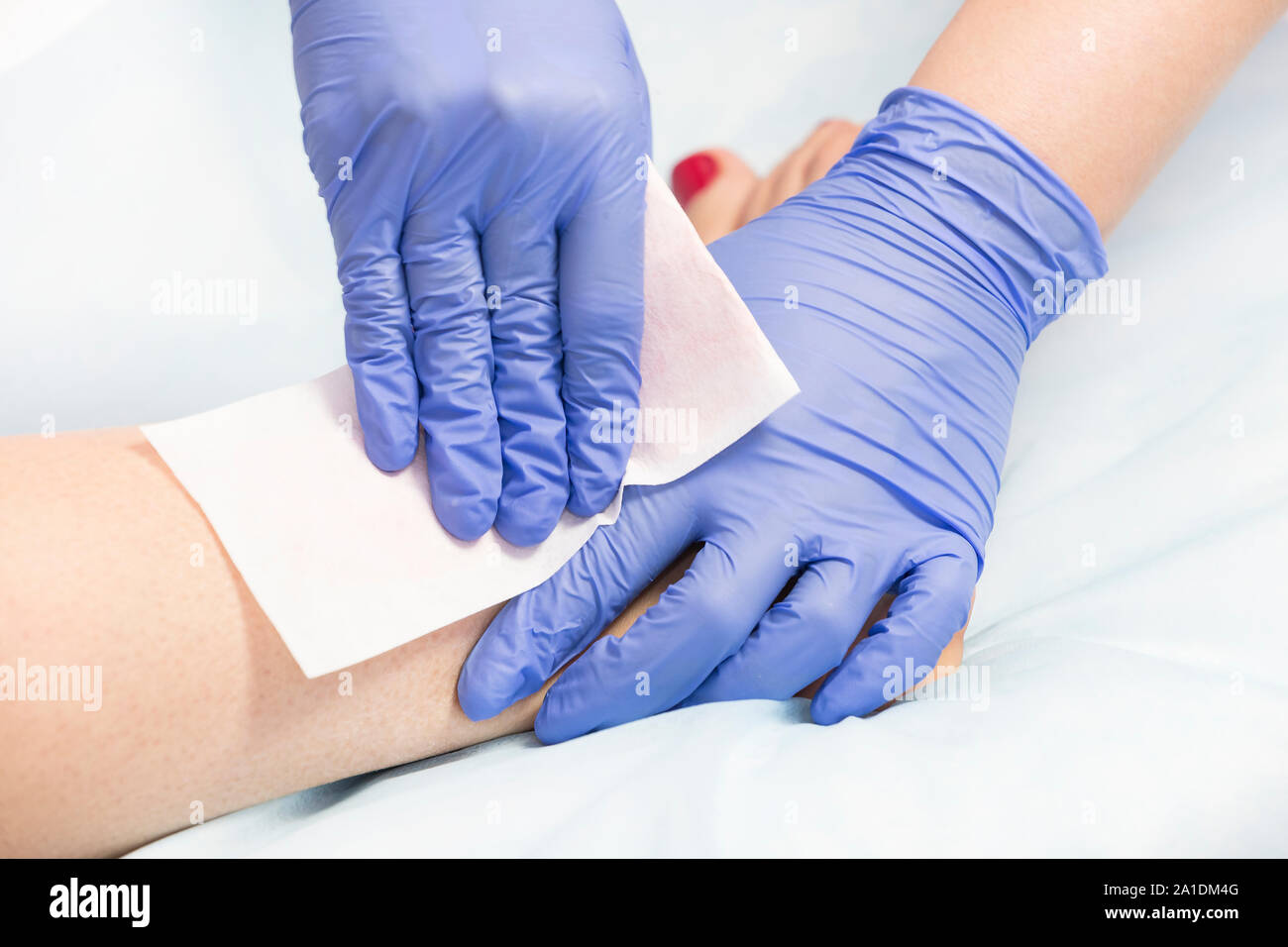 Closeup depilation process of female body parts in a beauty salon Stock