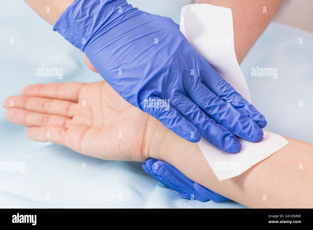 Closeup depilation process of female body parts in a beauty salon Stock