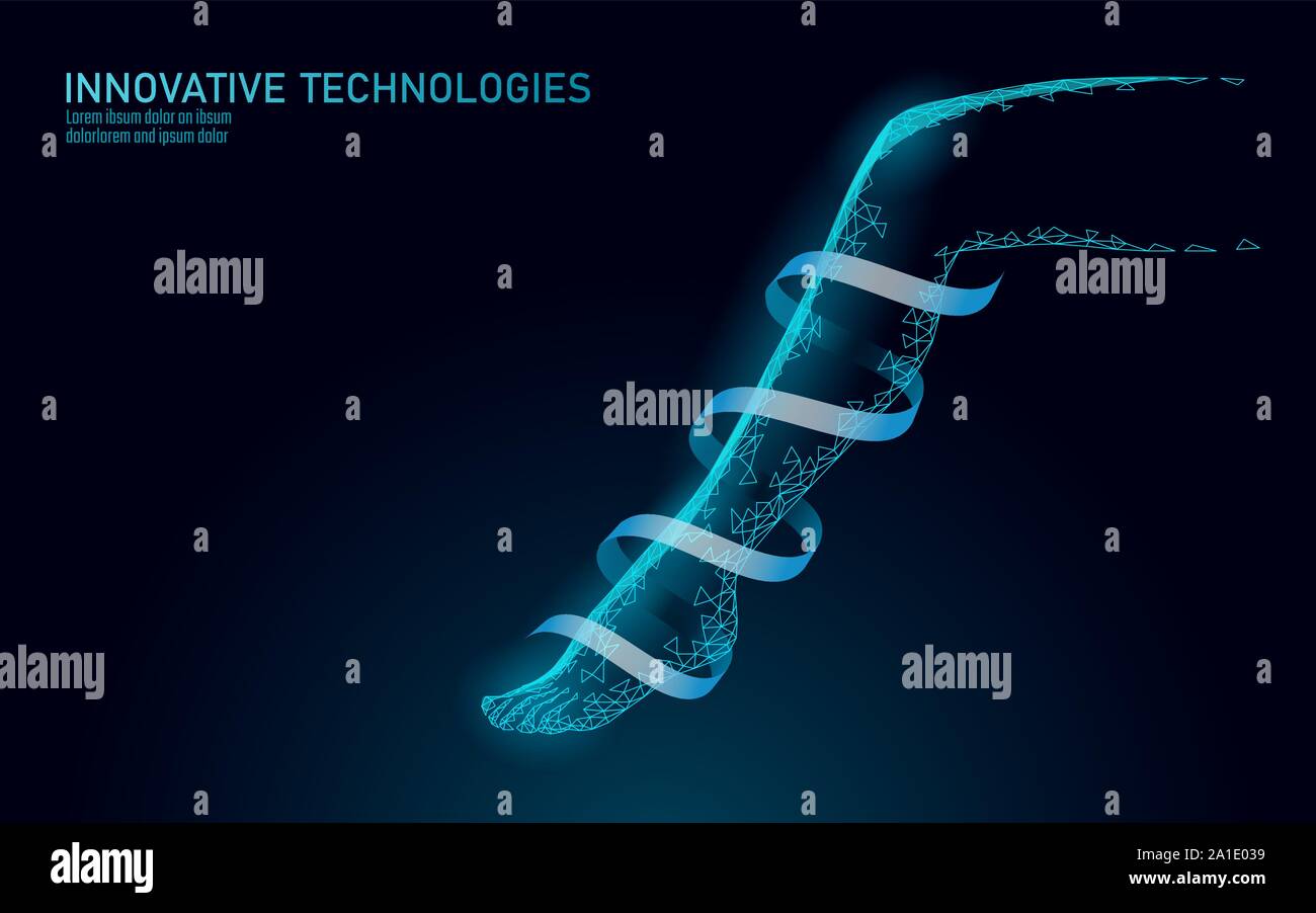 Varicose veins leg and foot hires stock photography and images Alamy