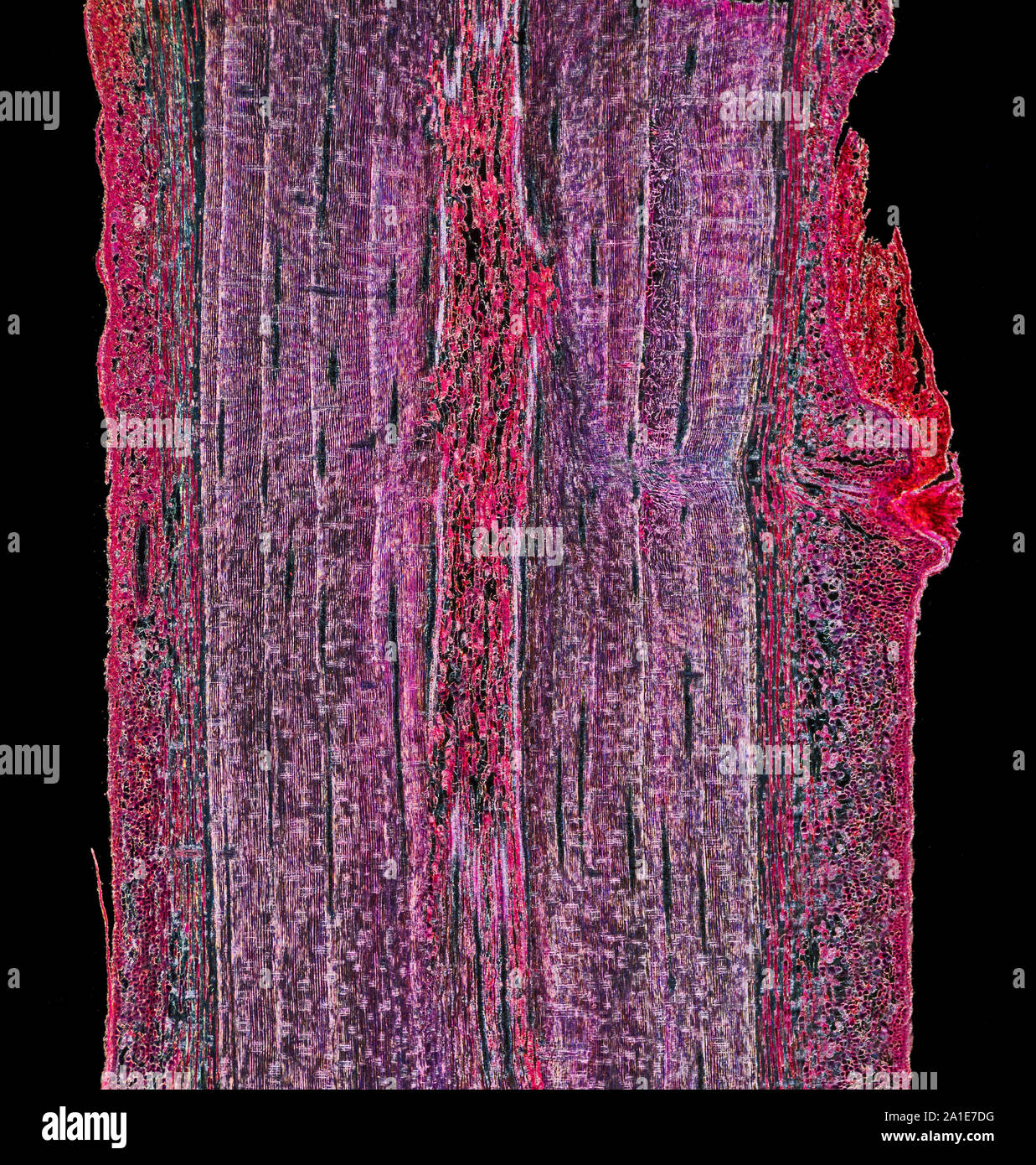 Pinus, old stem RLS, darkfield illumination photomicrograph Stock Photo