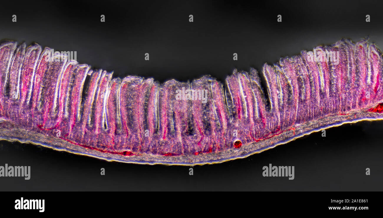 Small intestine villi, TS. injected, darkfield illumination photomicrograph Stock Photo