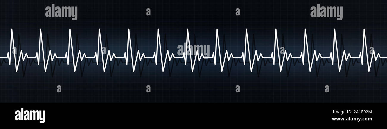 medical banner illustrating rapid heart pulse on ecg. heart rate more than 90 beats per minute. emotioanl stress, physical pressure, heart disease Stock Photo