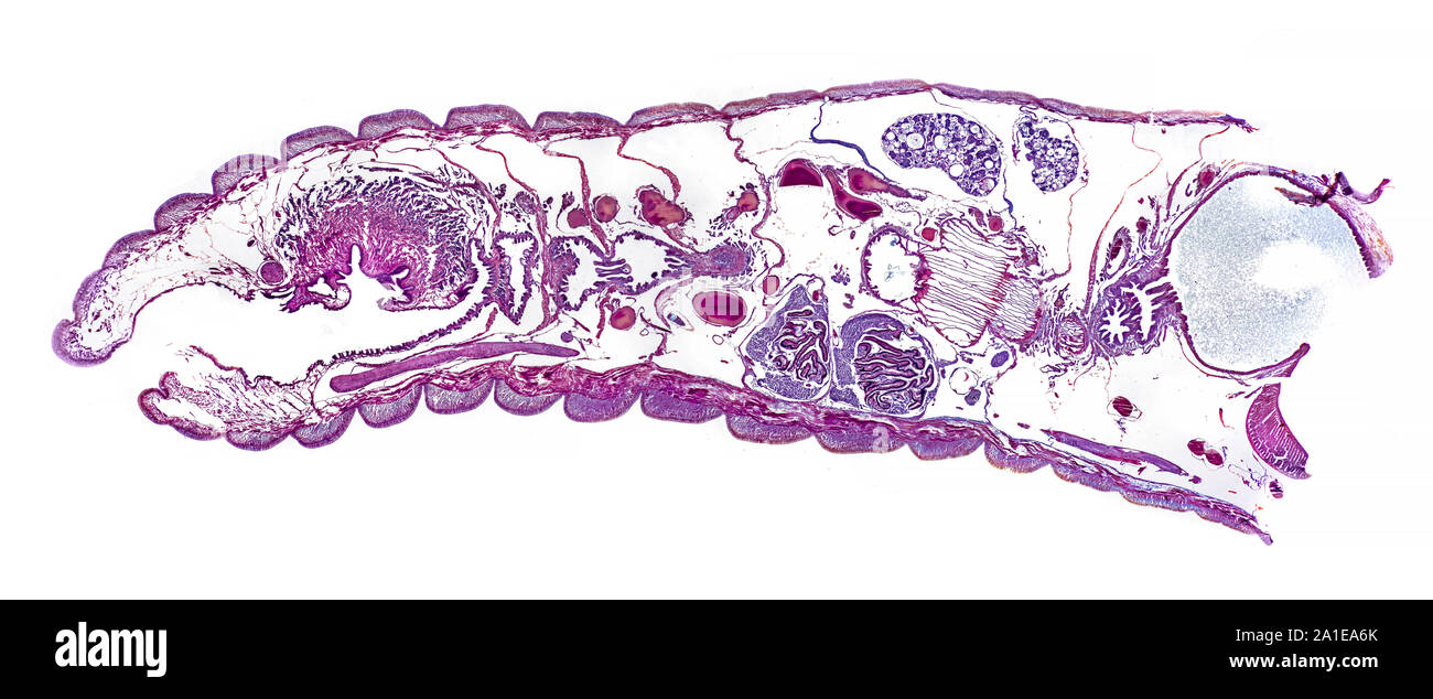 Earthworm,  Lumbricus terrestris , first 15 segments, LS brightfield photomicrograph Stock Photo