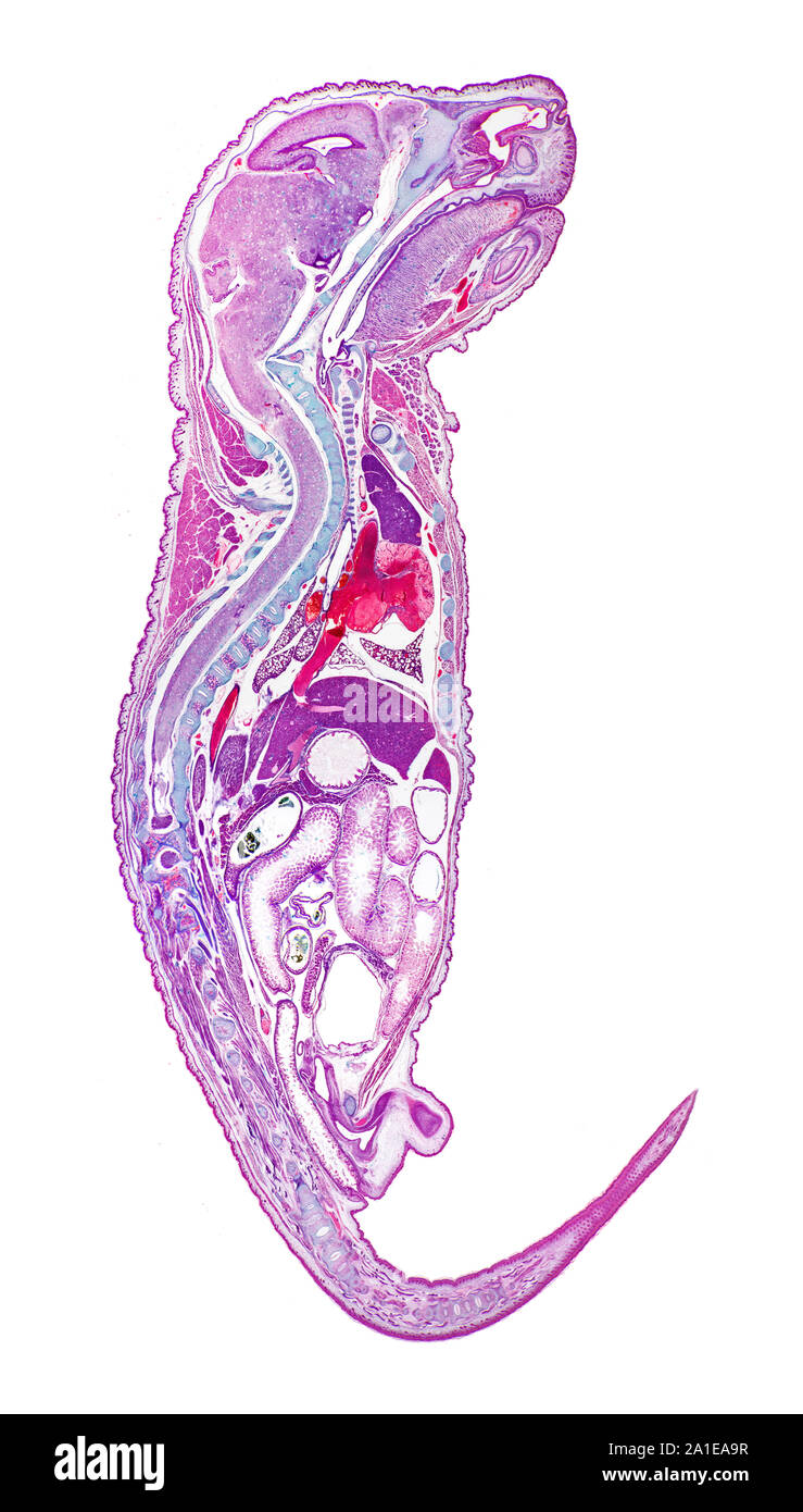 Mouse embryo, sagittal, LS. median, Brightfield photomicrograph Stock Photo