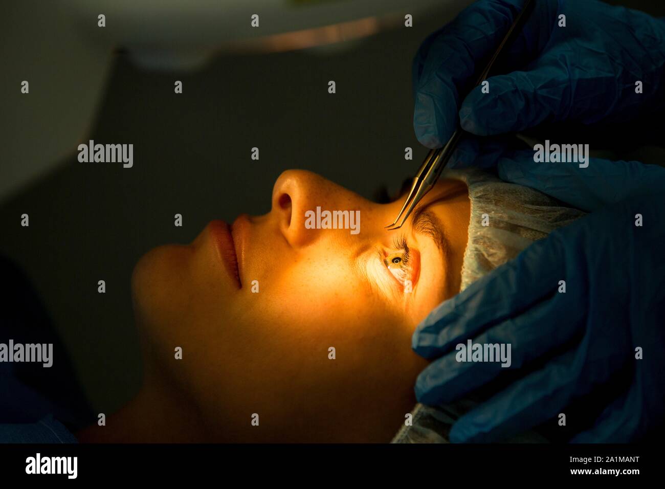 Patient undergoing laser eye surgery Stock Photo Alamy