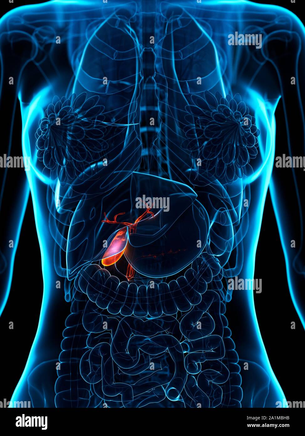 Diseased gallbladder, computer illustration Stock Photo