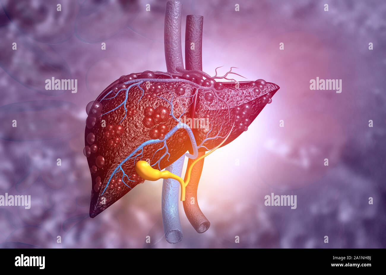 3d illustration of Abstract medical background with Diseased liver Stock Photo